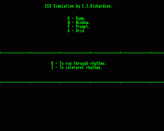 ECG Simulator