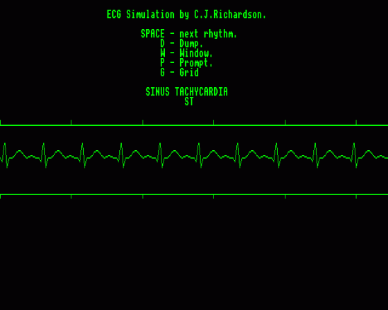 ECG Simulator