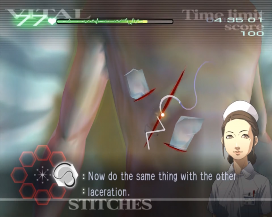 Trauma Center: Second Opinion Screenshot 5 (Nintendo Wii (US Version))