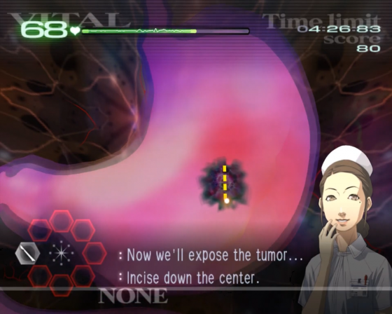 Trauma Center: Second Opinion Screenshot 53 (Nintendo Wii (US Version))