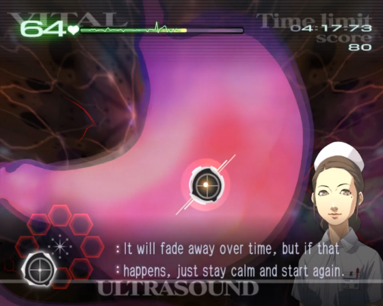 Trauma Center: Second Opinion Screenshot 54 (Nintendo Wii (US Version))