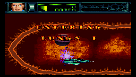 Rex Ronan: Experimental Surgeon Screenshot 7 (Super Nintendo (US Version))